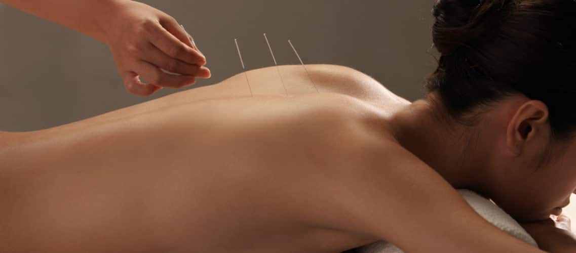 remboursement acupuncture