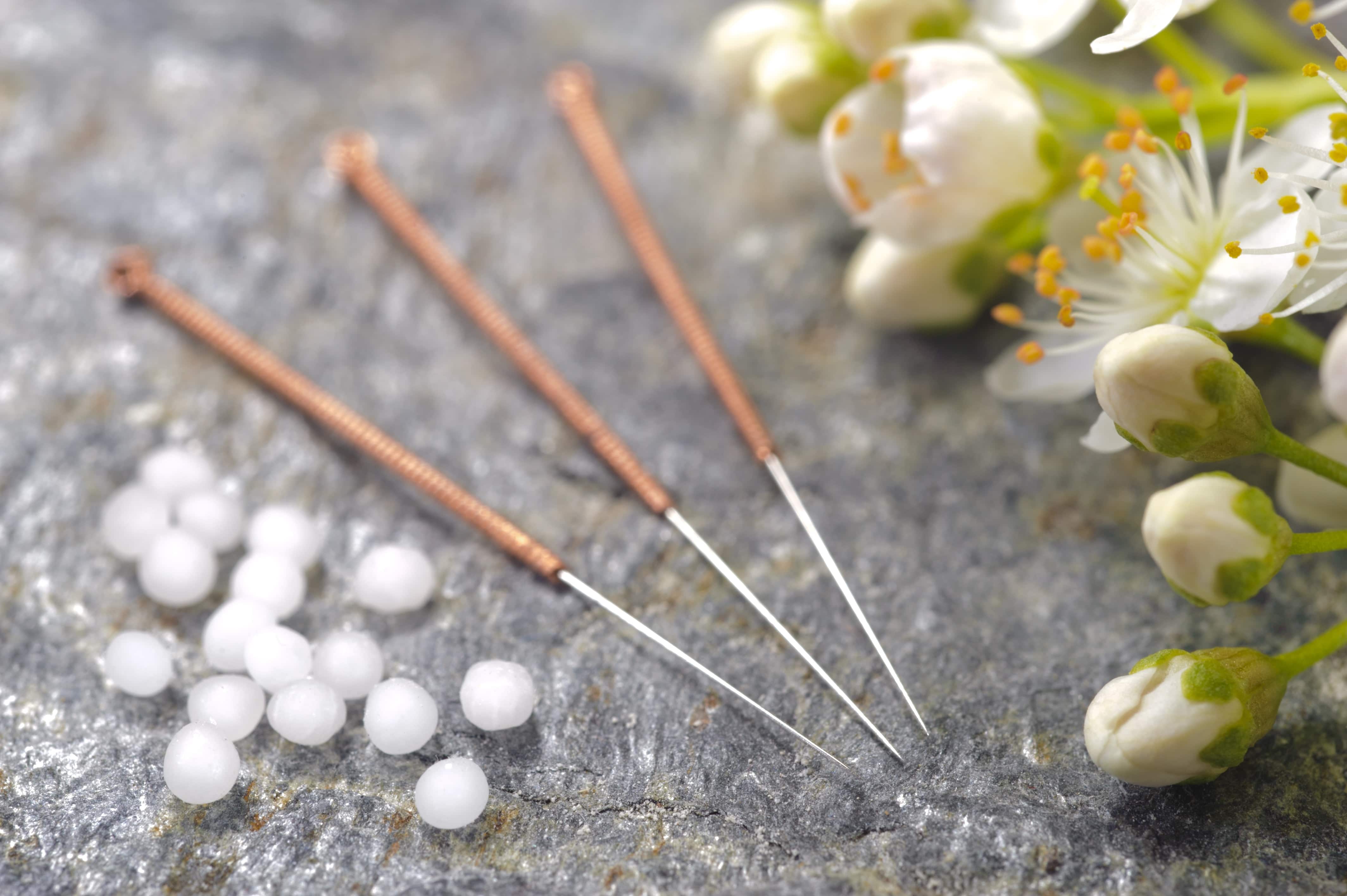 Remboursement Acupuncture Ce que vous devez savoir Hyperassur