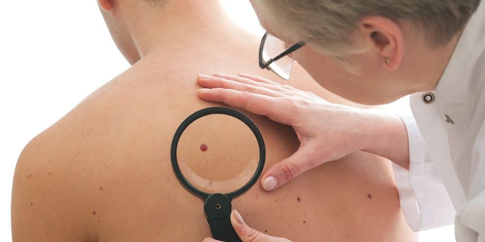 Remboursement dermatologue