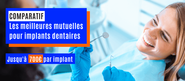 Les meilleures mutuelles implants dentaires - Comparatif 2021