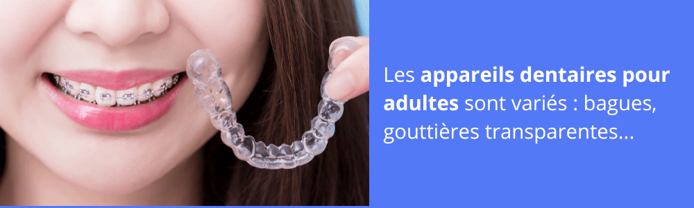 orthodontie adulte