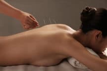 remboursement acupuncture